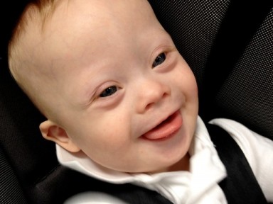 down-syndrome-smile-baby-kid-child-640x480